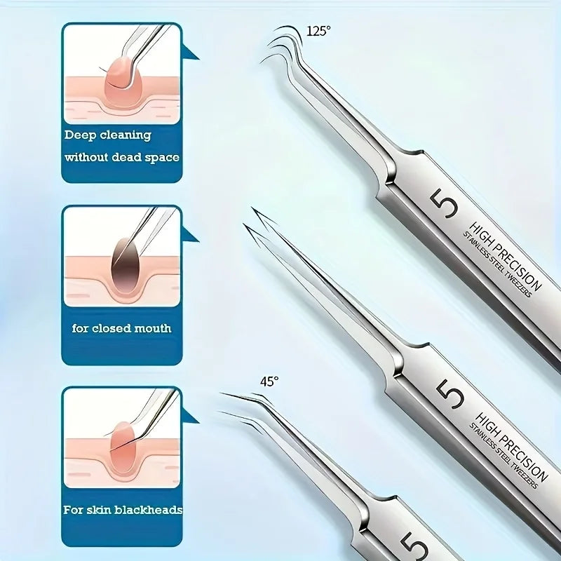 Professional Stainless Steel Blackhead Remover Set – Precision Skincare Tools by Mallinaz