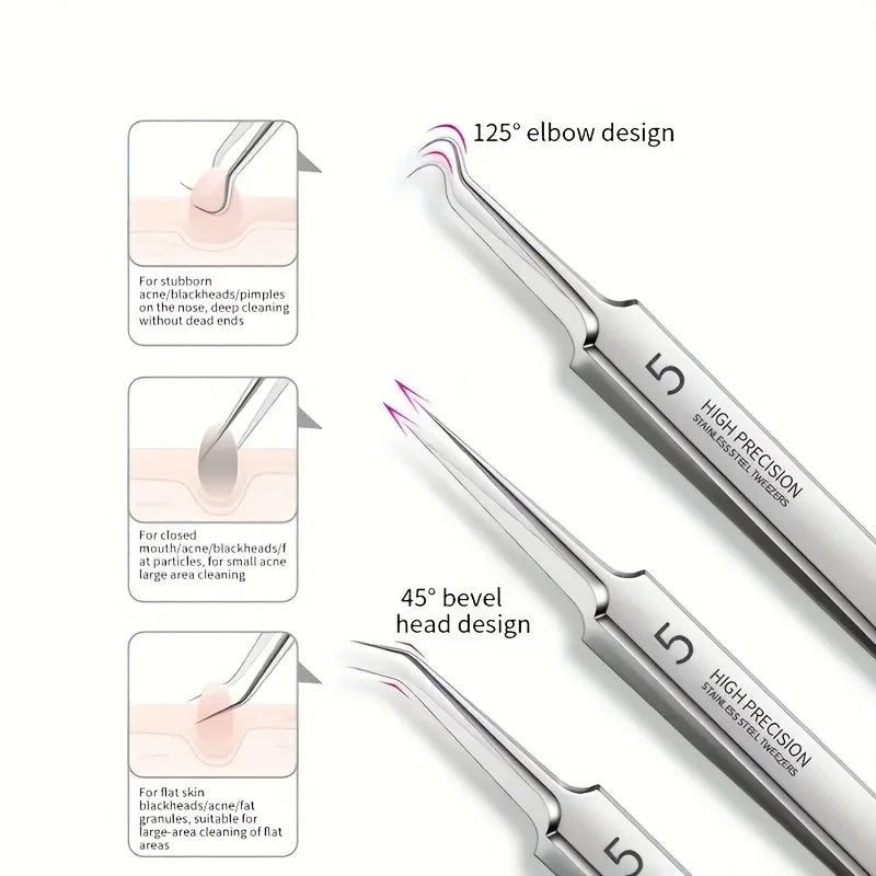 Professional Stainless Steel Blackhead Remover Set – Precision Skincare Tools by Mallinaz