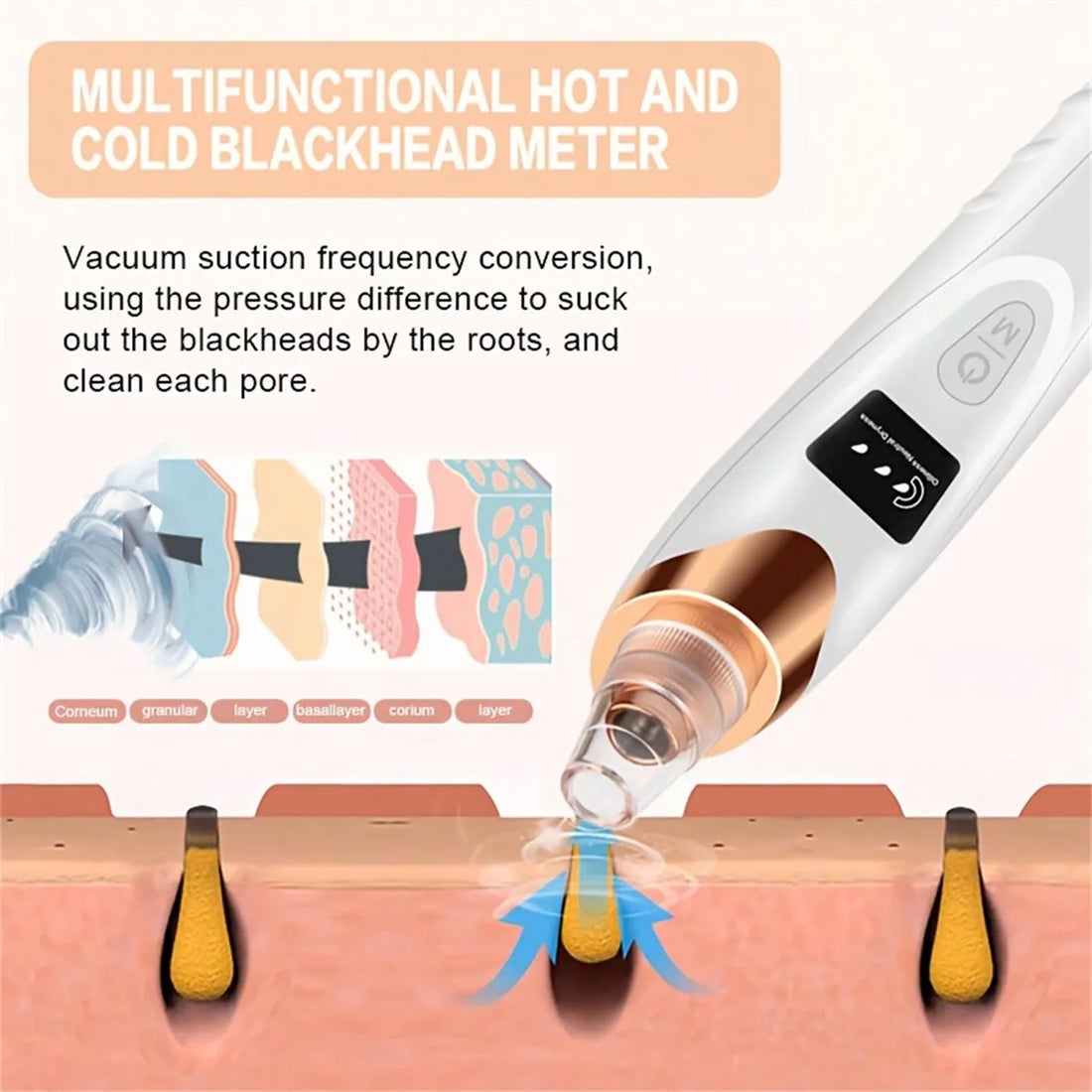 Electric Pore Vacuum &amp; Blackhead Remover – Deep Facial Cleansing Device by Mallinaz