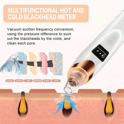 Electric Pore Vacuum &amp; Blackhead Remover – Deep Facial Cleansing Device by Mallinaz