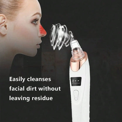Electric Pore Vacuum &amp; Blackhead Remover – Deep Facial Cleansing Device by Mallinaz