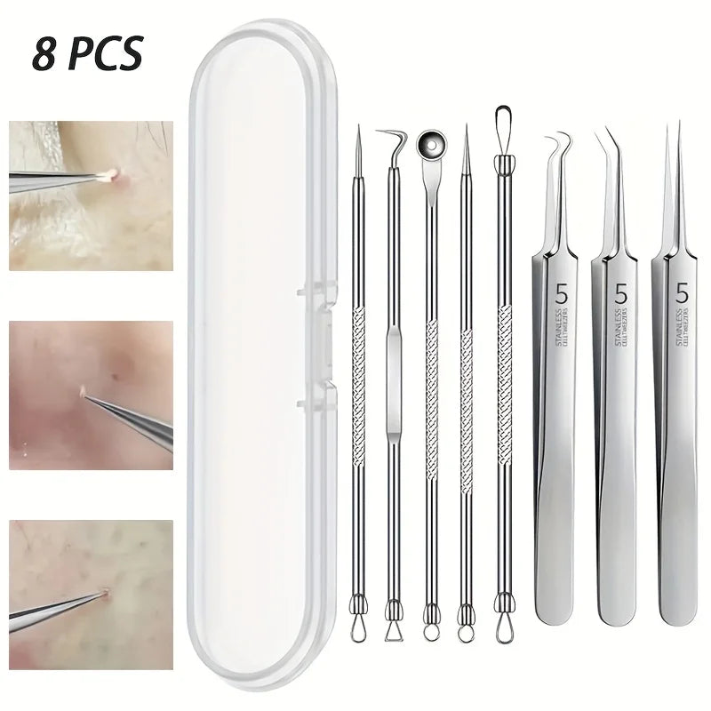 Professional Stainless Steel Blackhead Remover Set – Precision Skincare Tools by Mallinaz